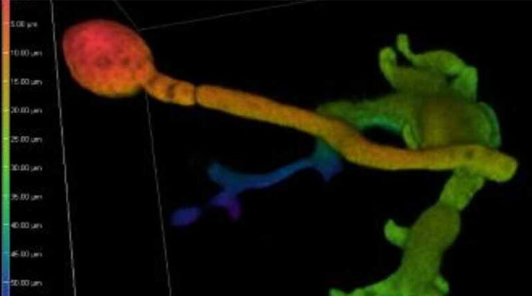 New research sheds light on role of copper-dependent enzymes in plant infection