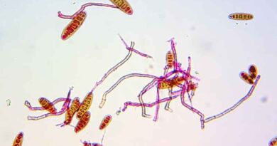 Two approaches better than one: identifying spot blotch resistance in wheat varieties